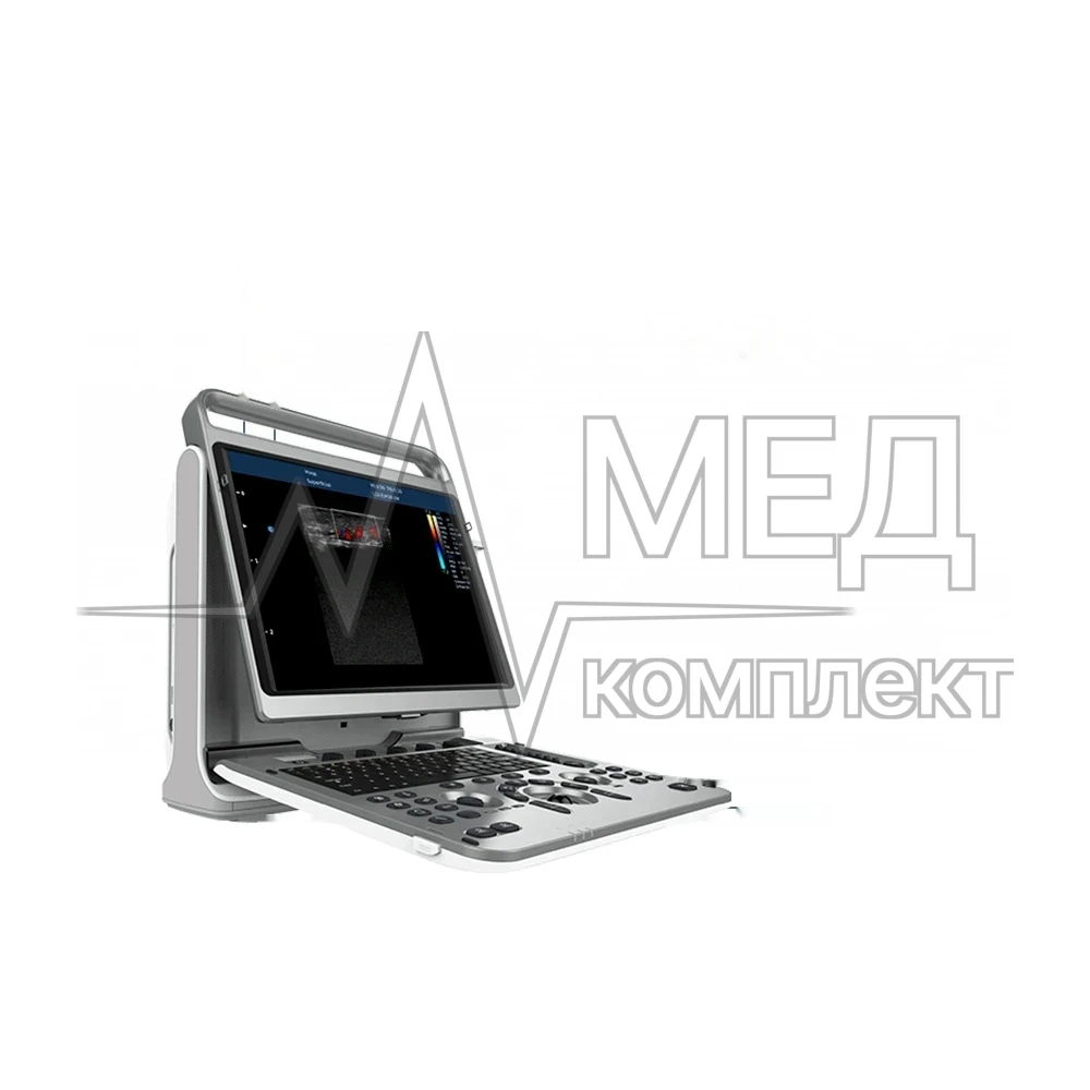Chison SonoTouch 60 (без кардио)