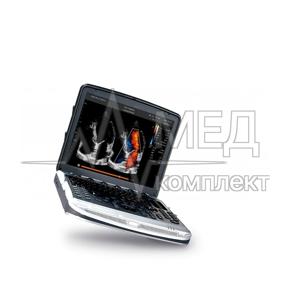 Chison Sonotouch 80 (SonoBook 8)