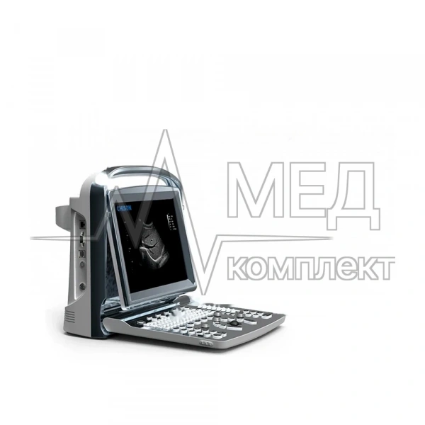 Chison SONOTOUCH 10