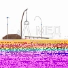 Кровать-кресло с "ушками" для сна в положении сидя МЕТ REALTA с регулировкой высоты, с переворотом и туалетом (с матрасом)