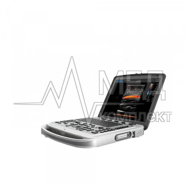 Chison Sonotouch 80 (SonoBook 6)