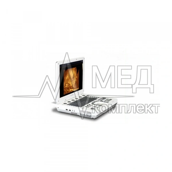 УЗИ аппарат Samsung Medison MySono-U5