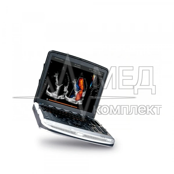 Chison Sonotouch 80 (SonoBook 8)