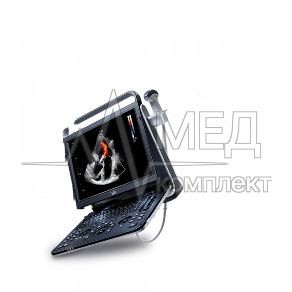 Chison SonoTouch 60