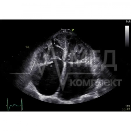 Аппарат УЗИ (сканер) GE Healthcare Vivid E90