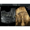 Аппарат УЗИ (сканер) GE Healthcare Voluson P8