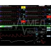 Станция мониторная центральная Treaton СЦМ2.24