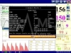 Фетальный монитор Edan F9 Express