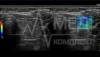 Аппарат УЗИ (сканер) GE Healthcare Logiq S8
