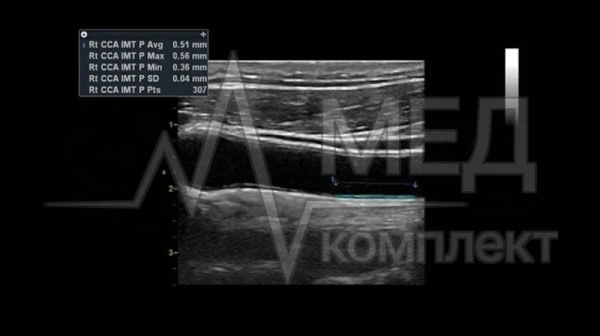 Аппарат УЗИ (сканер) GE Healthcare Vivid T9