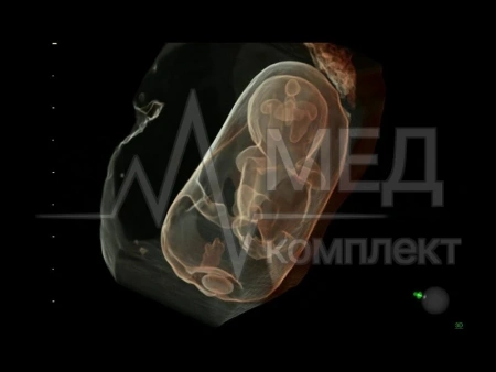 Аппарат УЗИ (сканер) GE Healthcare Voluson E10