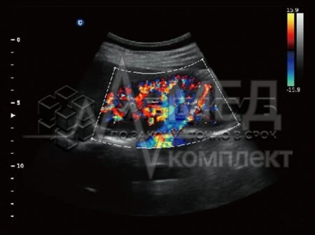 Аппарат УЗИ (сканер) Chison QBit 5