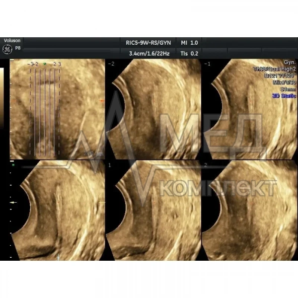 Аппарат УЗИ (сканер) GE Healthcare Voluson P8