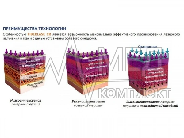 Лазерный хирургический аппарат IPG FiberLase CR для регенерации хрящевой ткани и противоболевой терапии