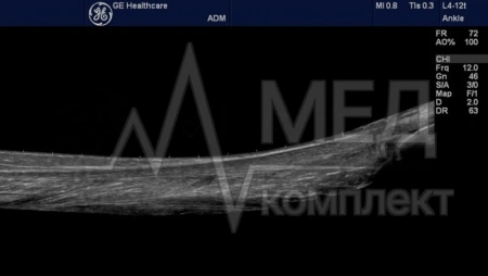 Аппарат УЗИ (сканер) GE Healthcare Logiq e