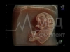 Аппарат УЗИ (сканер) GE Healthcare Voluson E10