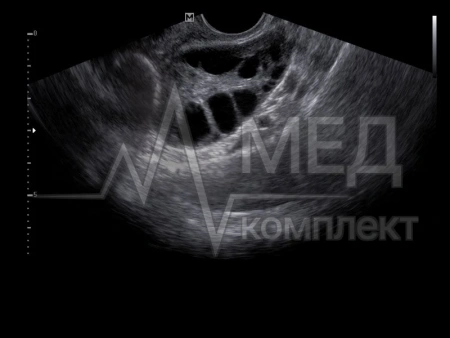 Аппарат УЗИ НПО Сканер РуСкан 50