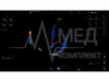 Аппарат УЗИ (сканер) GE Healthcare Versana Premier Black