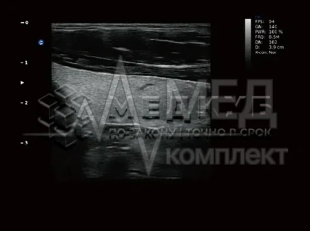 Аппарат УЗИ (сканер) Chison Qbit 3