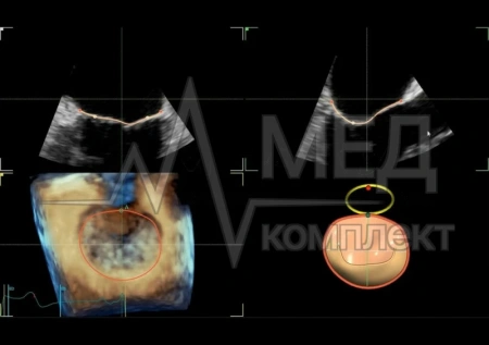 Аппарат УЗИ (сканер) GE Healthcare Vivid E95