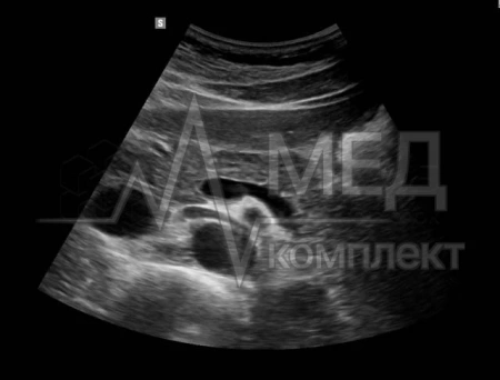 Аппарат УЗИ НПО Сканер РуСкан 65М