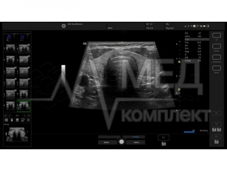 Аппарат УЗИ (сканер) GE Healthcare Versana Essential