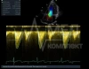 Аппарат УЗИ (сканер) GE Healthcare Vivid T9