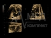 Аппарат УЗИ (сканер) GE Healthcare Voluson E10