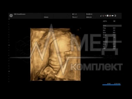 Аппарат УЗИ (сканер) GE Healthcare Versana Premier Black