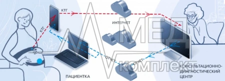 Система дистанционного кардиотокографического мониторирования БИОСС ФМП