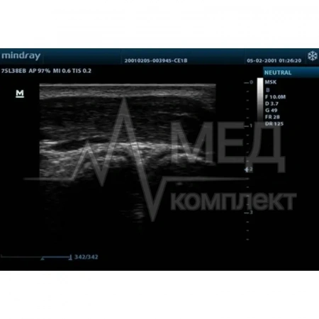 Аппарат УЗИ (сканер) Mindray M9T