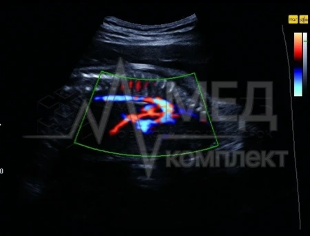 УЗИ-аппарат портативный НПО Сканер РуСкан 70П