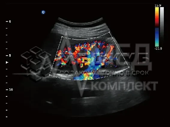 Аппарат УЗИ (сканер) Chison Qbit 3