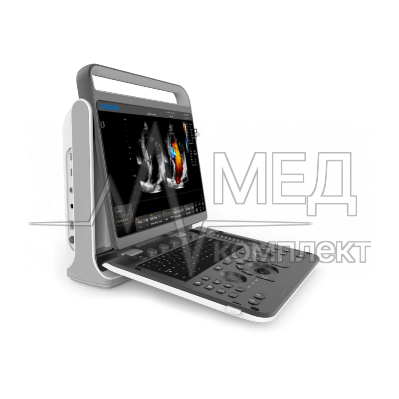 Аппарат УЗИ (сканер) Chison SonoTouch 60 Pro